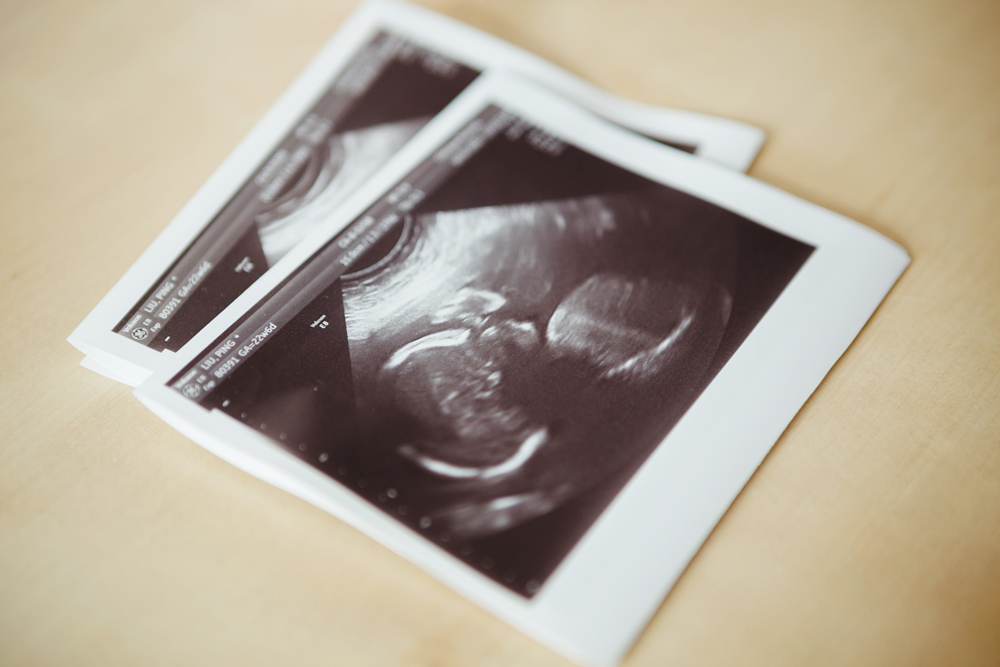 Sonogram of the bride's baby